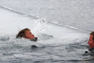 An Image Of A Person Suffering From Hypothermia.